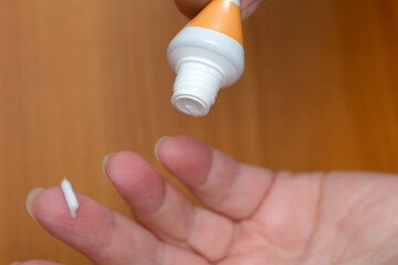 Applying soothing cream to relieve skin irritation on a hand