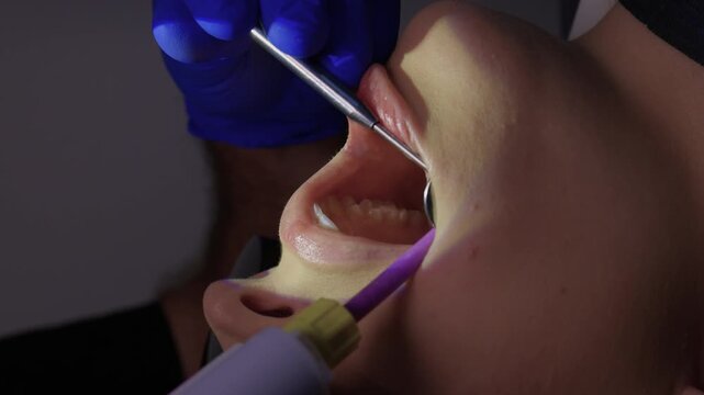 Highlighting the Importance of Orthodontic Impressions in Dental Procedures and Care