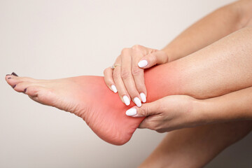 Woman holding painful foot. Red irritated skin. Health problem and soreness. Massage for relief of tired legs. Medical injury and inflammation concept. Body care and treatment for pain symptom.