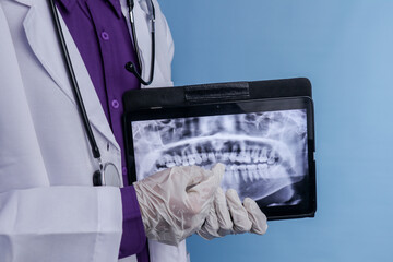 A female doctor wearing stethoscope is holding a dental panoramic result on a tablet on an isolated background