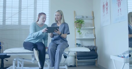 Prosthetic leg patient and therapist discussing exercise using tablet in clinic, with muscle charts