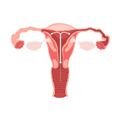 Female Reproductive System with IUD Contraception