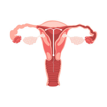 Female Reproductive System with IUD Contraception