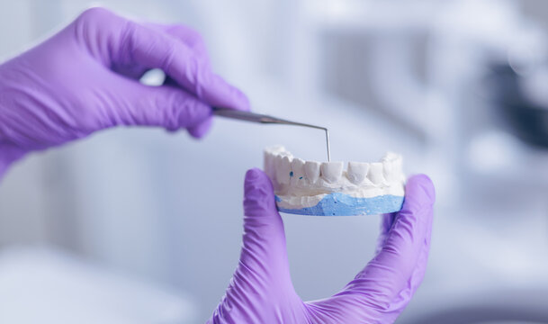 Dental technician working on dental cast with precision tools