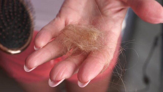 Close-up of woman showing fallen hair in her hand after brushing. Symbol of hair loss, damaged scalp, stress, and need for treatment or health care concept.
