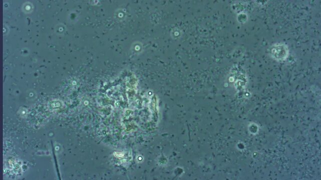 Movement of numerous small bacteria in liquid among organic fragments, water from drinking sources under microscope magnification.