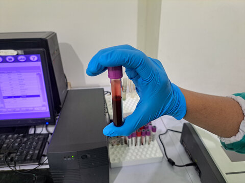 Laboratory technician holding a blood sample tube with gloves, medical test concept, healthcare, laboratory analysis, diagnostic examination, hospital research background.