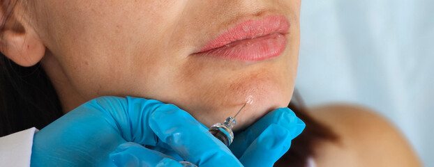 Syringe near woman's chin, beauty injections with fillers for chin shape correction