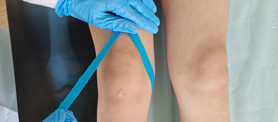 Physiotherapist applying kinesio tape on girl knee