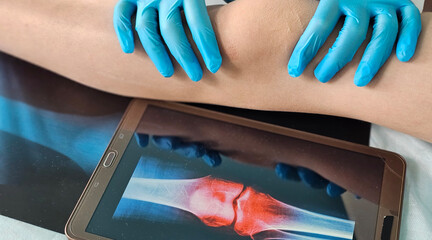 Doctor holding x-ray and examines child leg