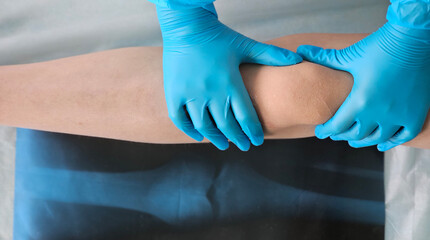 Woman doctor holding x-ray and examines child leg concept