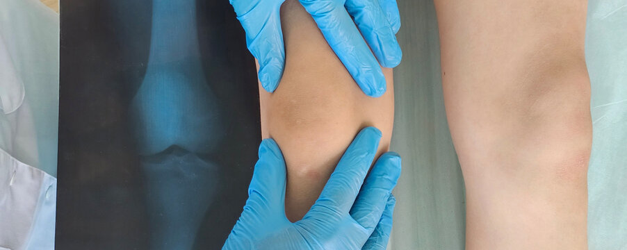 Doctor examines X-ray of little girl leg