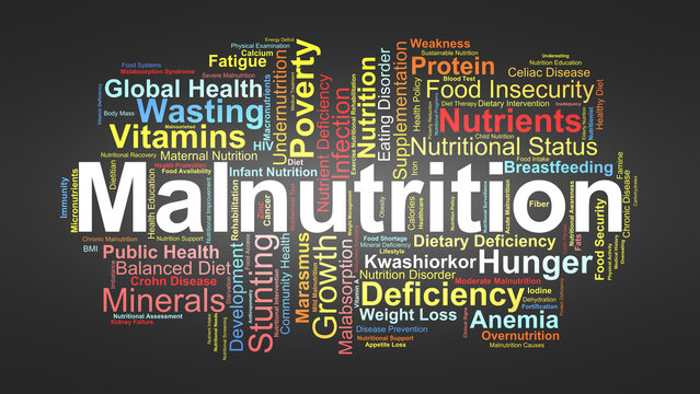 Malnutrition Word Cloud. Key Concepts On Nutrient Deficiency, Undernutrition, Causes, Symptoms, Diagnosis, Treatment, And Global Health Impact.