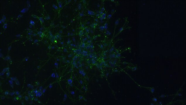 Microscopic view of brain glial cells highlighted with GFAP antibodies in green and DAPI staining in blue for cell nuclei