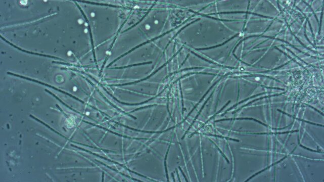 A colony of filamentous bacteria Microthrix parvicella under a microscope magnification of 400 times.