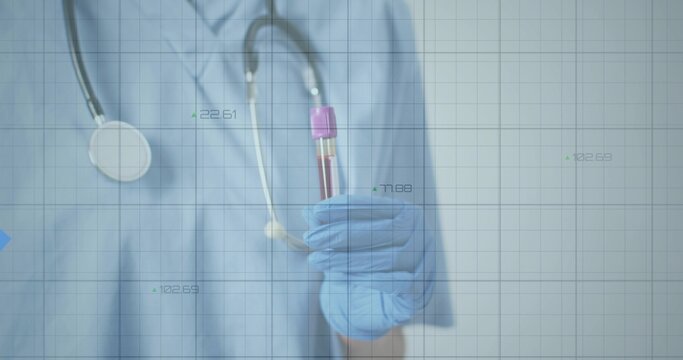 Displaying nurse wearing blue glove holding blood tube with purple cap in lab with data grid - Powered by Adobe