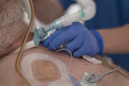 Nurse adjusting tracheostomy tube on intubated patient
