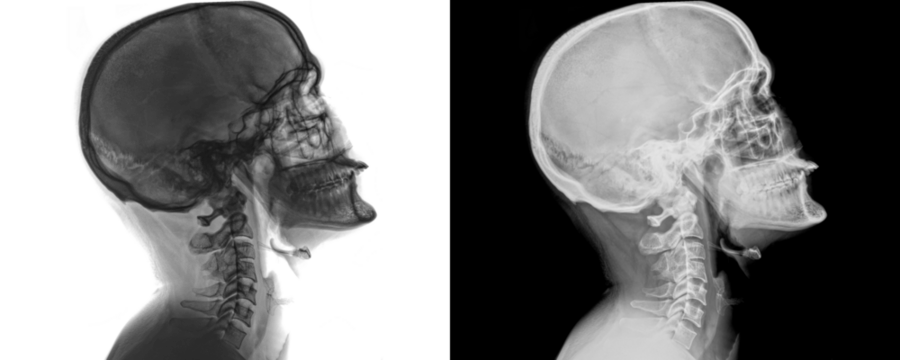 Lateral Neck X-Ray of Cervical Vertebrae and Soft Tissue Details for Medical Diagnosis Isolated on a Transparent or White Background