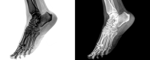 Foot Lateral View X-Ray Radiograph Showing Bone and Joint Anatomy for Fracture Detection, Dislocation Assessment, and Skeletal Structure Evaluation Isolated on a Transparent or White Background