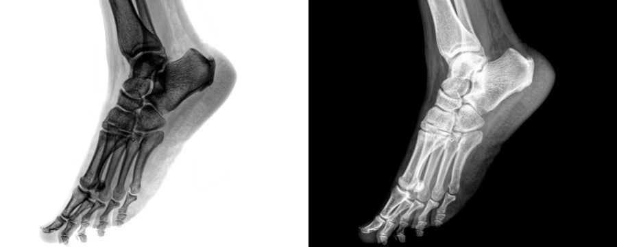Foot Lateral View X-Ray Radiograph Showing Bone and Joint Anatomy for Fracture Detection, Dislocation Assessment, and Skeletal Structure Evaluation Isolated on a Transparent or White Background