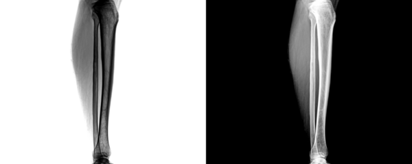 Leg Lateral View X-Ray Showing Tibia and Fibula Alignment for Fracture Detection, Bone Integrity Assessment, and Pre-Surgical Planning Isolated on a Transparent or White Bacground