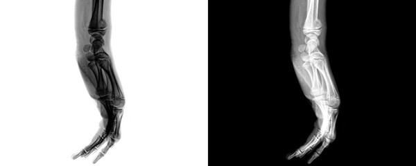 Wrist Joint Lateral View X-Ray Showing Carpal Bone Alignment for Diagnosing Fractures and...