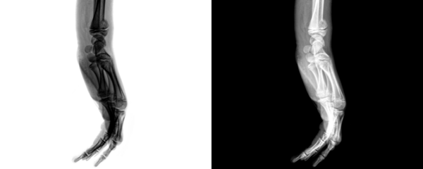 Wrist Joint Lateral View X-Ray Showing Carpal Bone Alignment for Diagnosing Fractures and Identifying Structural Abnormalities Isolated on a Transparent or White Background