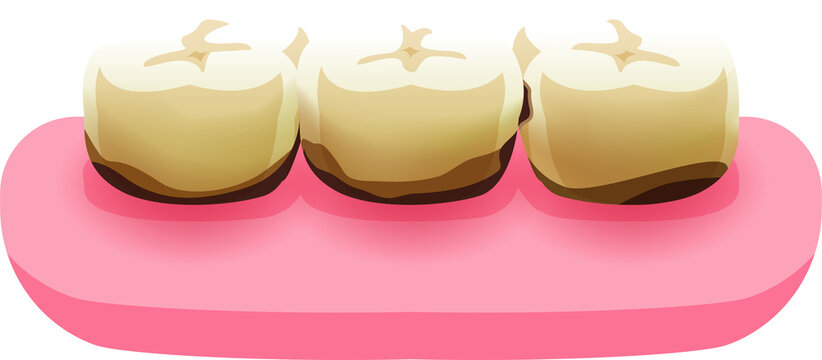 Decay teeth illustration transparent design. Dental care concept.
