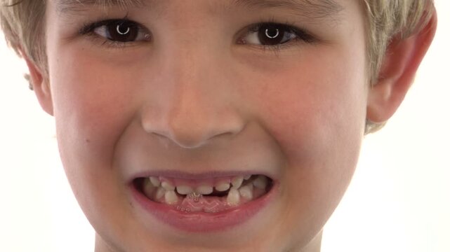 Close-Up of Young Boy Smiling Showing Missing Teeth on Isolated Background