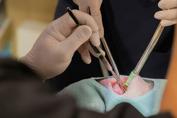 医療　歯科医　施術　イメージ