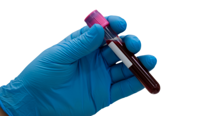 Medical professional's gloved hand holding a blood sample tube ready for laboratory testing and diagnostic procedures