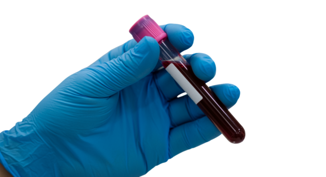 Medical professional's gloved hand holding a blood sample tube ready for laboratory testing and diagnostic procedures