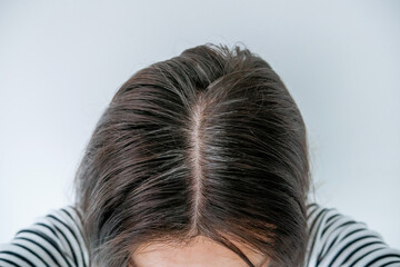 Close-up of a woman's scalp with visible gray hair roots and regrowth, showing hair parting and early signs of hair thinning – concept of aging, scalp health, and hair care treatment