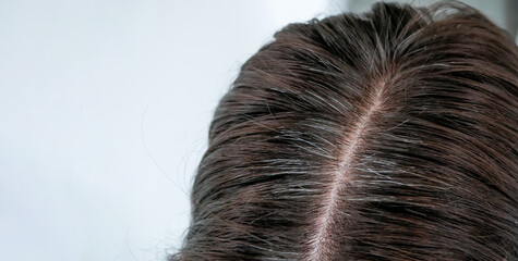 Close-up of a woman's scalp with visible gray hair roots and regrowth, showing hair parting and early signs of hair thinning – concept of aging, scalp health, and hair care treatment