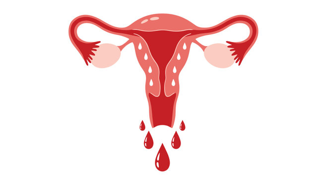 Illustration of the female reproductive system with blood drips, symbolizing menstruation or uterine bleeding.