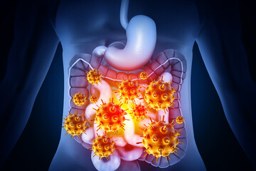 Virus or bacteria infected human digestive system. 3d illustration