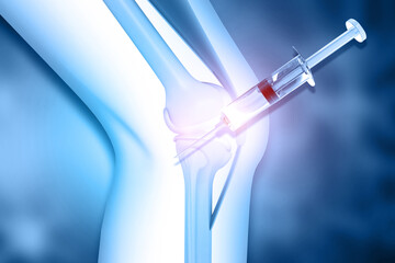 Human knee anatomy with medicine injection. 3d illustration © Rasi