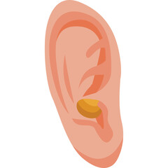Human Ear With Wax Buildup Isolated On Transparent Background Medical Illustration Of Auditory Canal With Earwax A Common Health Issue And Anatomy Detail