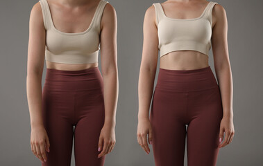 Before and after collage showing woman with good and bad posture against grey background, closeup