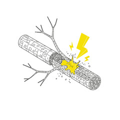 An abstract isometric line illustration depicting a damaged biological vessel or nerve with a painful burst, symbolizing injury or inflammation.