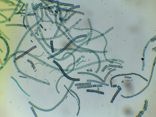 Microscopic View of the Filamentous Green Algae Ulothrix
