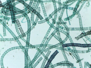 Microscopic View of the Filamentous Green Algae Ulothrix