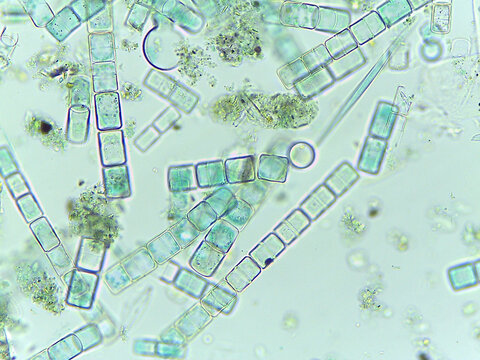 Microscopic View of the Filamentous Diatom Melosira Showing Auxospore Formation