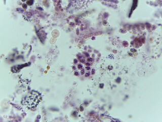 Microscopic View of a Colonial Green Alga, Pediastrum, Amidst