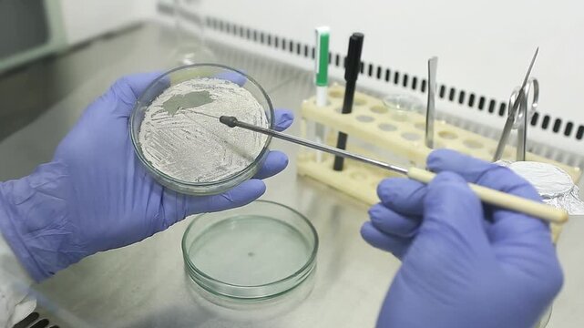 A scientist removes a white bacterial strain from the surface of nutrient agar in a petri dish while working with bacterial strains in a microbiology laboratory.