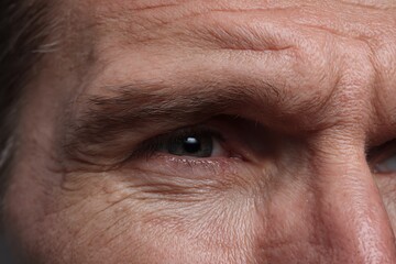 macro adult forehead skin, fine expression lines, realistic dermatology lighting