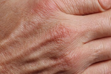 macro adult hand skin, soft wrinkles, natural tone, dermatologic detail