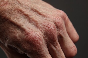 Naklejka premium macro mid-age hand skin, visible veins, soft wrinkles,
