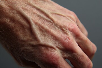 Fototapeta premium macro mid-age hand skin, visible veins, soft wrinkles,