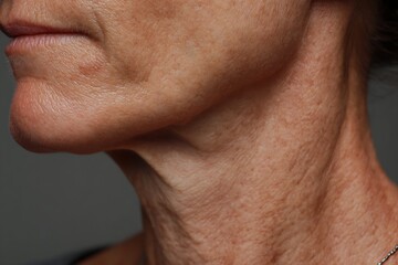 Naklejka premium macro neck skin mid-age, visible wrinkles, natural tone